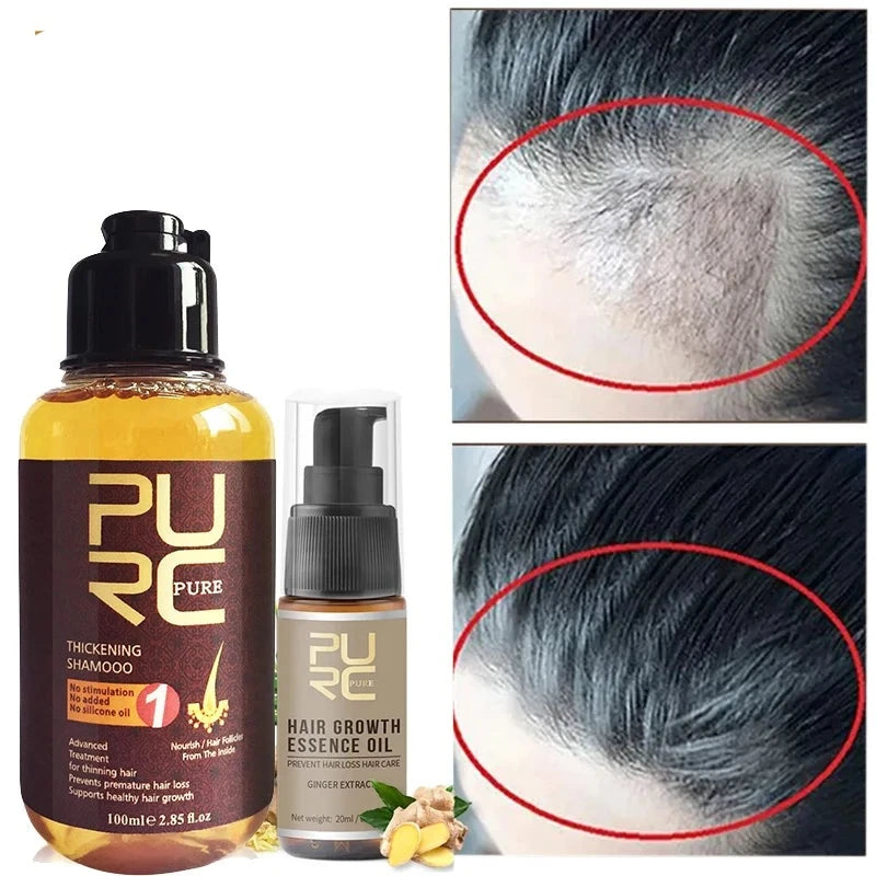 Hair Growth Oil